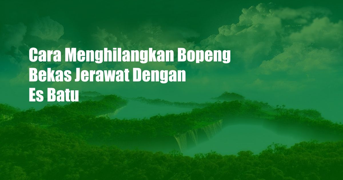 Cara Menghilangkan Bopeng Bekas Jerawat Dengan Es Batu